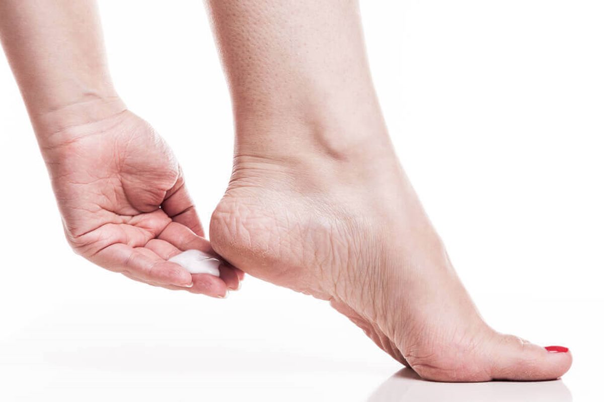 Como acabar com as rachaduras nos pés? Três receitas eficazes