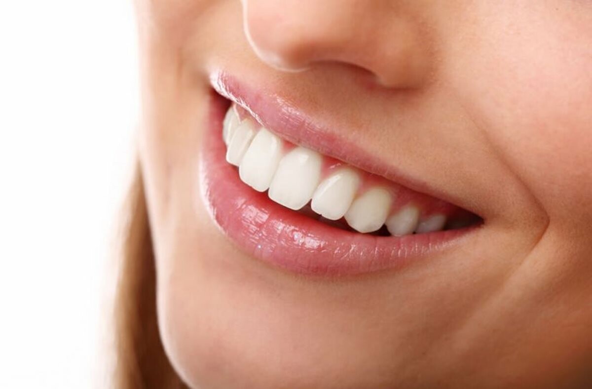 Remédios caseiros eficazes que vão clarear os dentes amarelados
