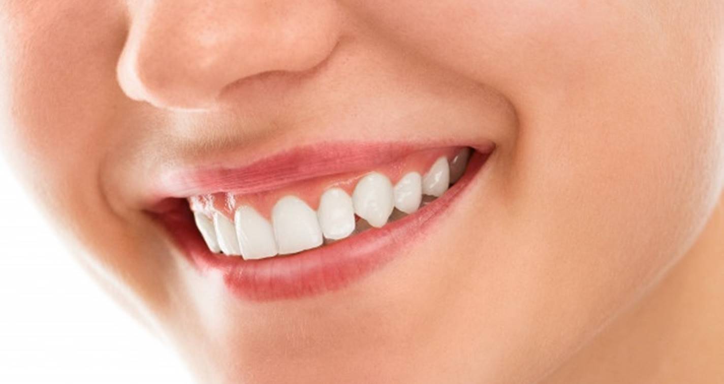 Quais os alimentos e bebidas que danificam os dentes e como reverter seus efeitos?
