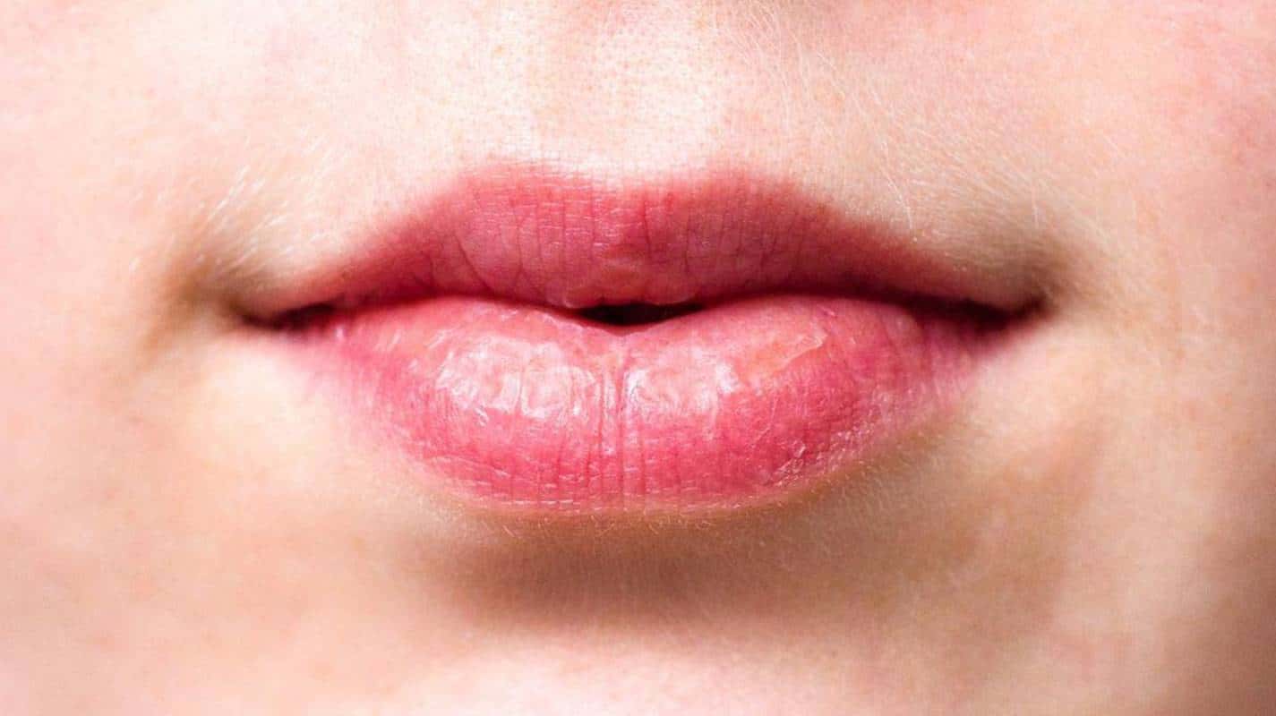 Lábios secos e enrugados: Faça um bálsamo hidratante caseiro suave