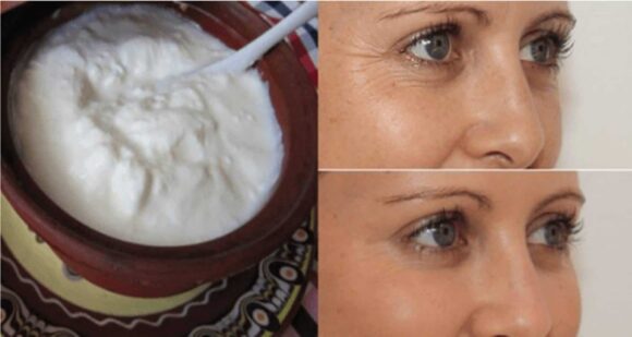 Faça um creme caseiro de linhaça e arroz para remover rugas