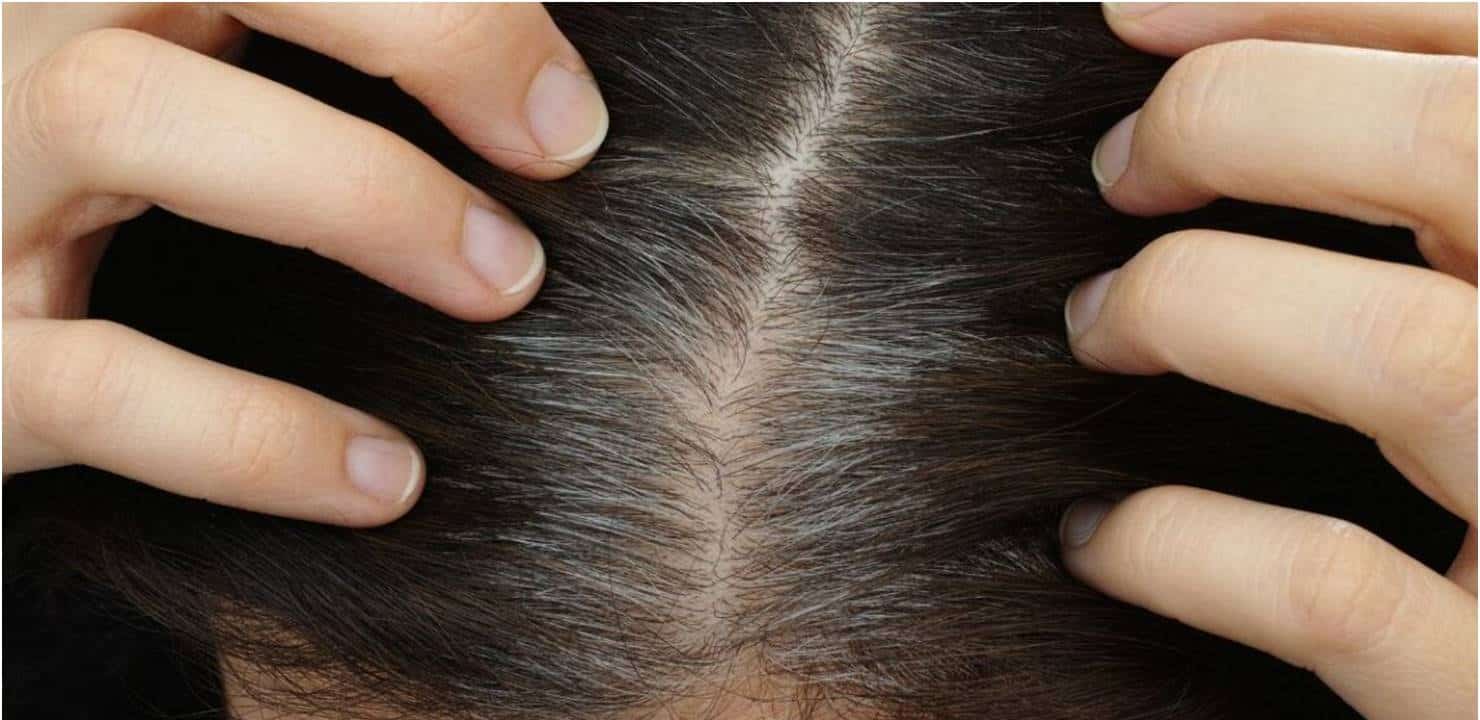 Como aumentar a melanina nos cabelos e evitar fios brancos