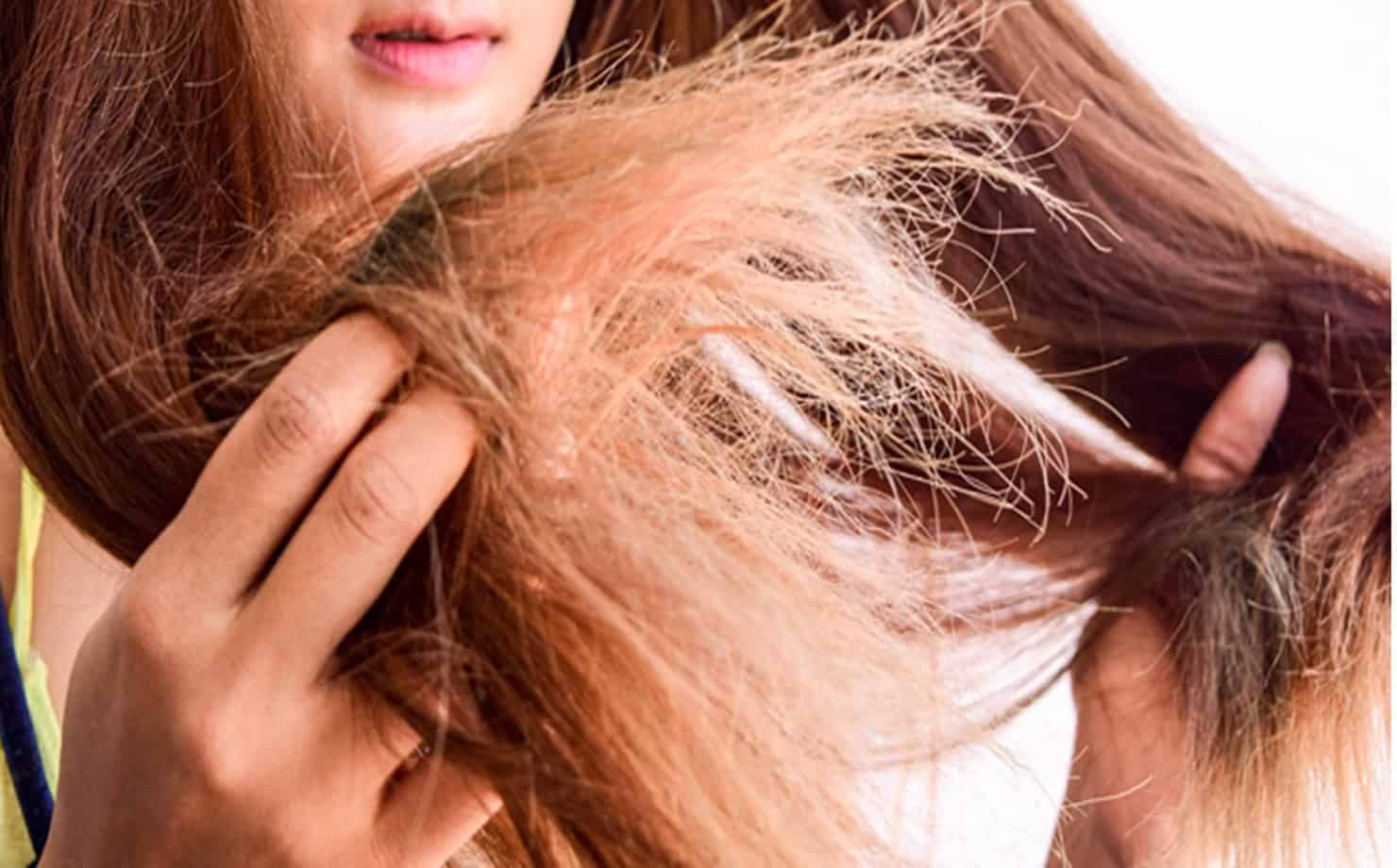5 dicas para dar vida ao cabelo seco e danificado 