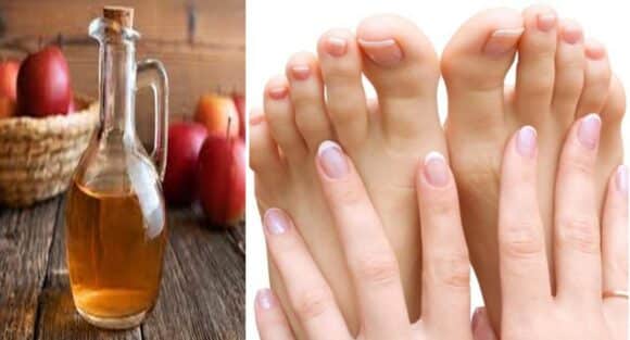 Diversas maneiras de usar o vinagre de maçã para cuidar das unhas