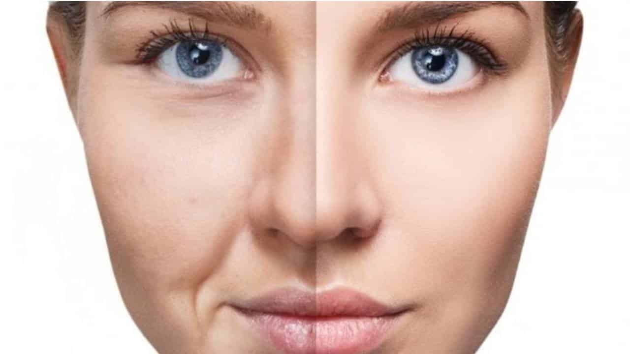 Botox Caseiro: veja como fazer usando ingredientes naturais