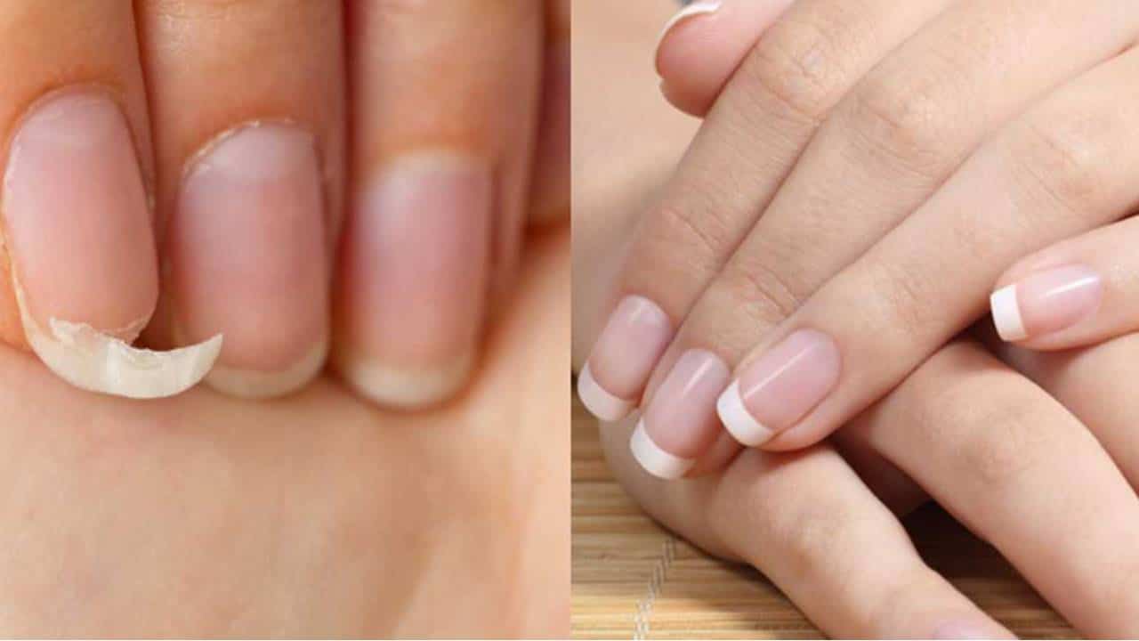 Como endurecer as unhas sem alho: 3 receitas infalíveis