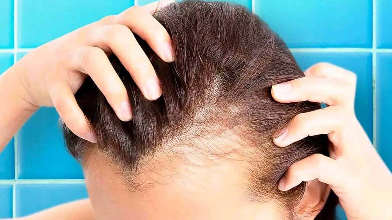 11 remédios caseiros para combater a queda de cabelo