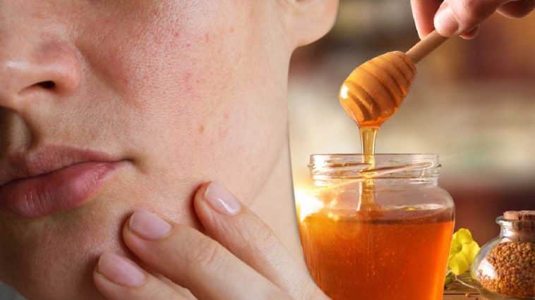 Método do mel: esse é o segredo para reduzir as rugas e linhas de expressão da pele