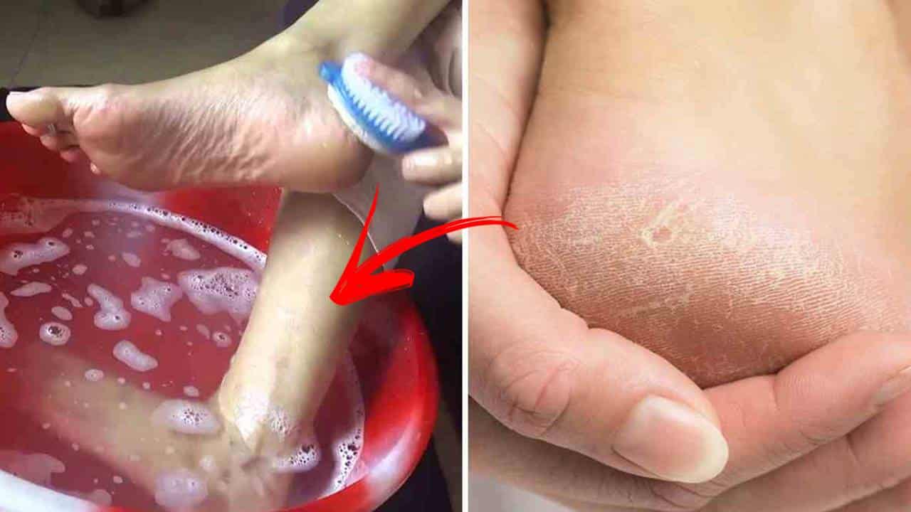 Por que colocar os pés dentro da água com bicarbonato 1 vez por mês