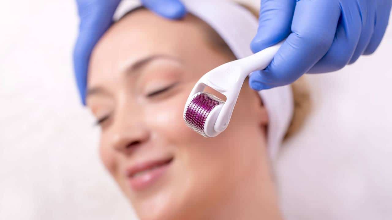 Micro-Coring: como funciona este tratamento para firmar a pele