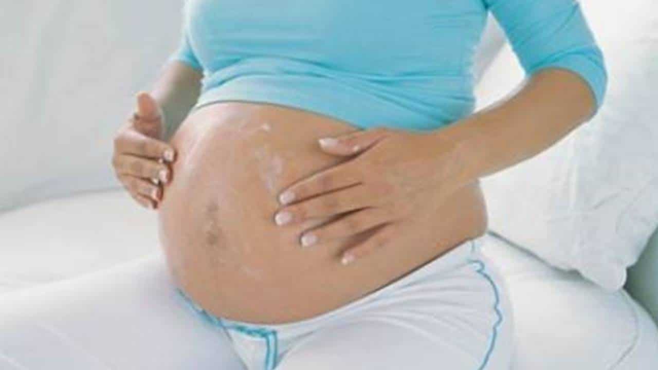 6 dicas para prevenir o aparecimento de estrias durante a gravidez