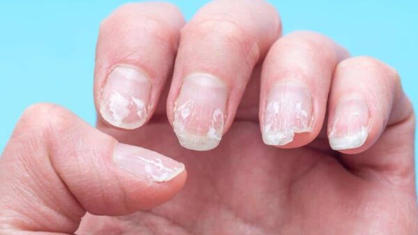 Siga esses cuidados com as unhas para que não quebrem