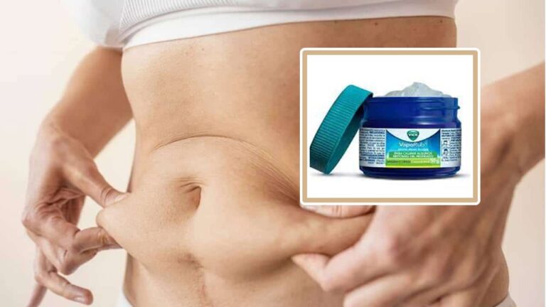 Este truque com Vick Vaporub ajuda a reduzir a flacidez abdominal