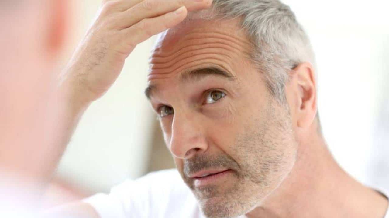 Conheça a Tricopigmentação: a solução para os problemas de calvície e alopecia