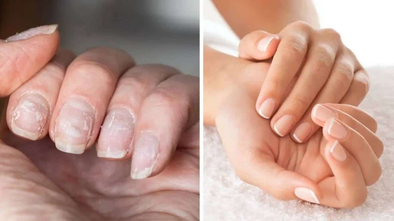 fortalecer unhas quebradiças