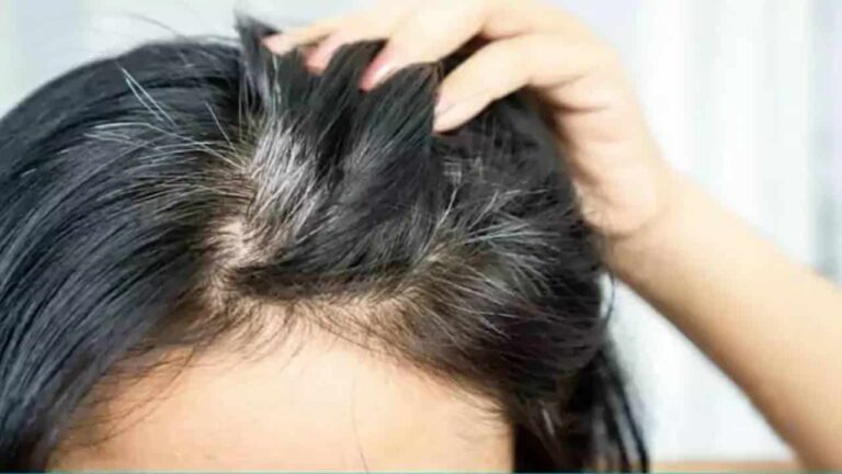 Muitas mulheres usam esse método para cobrir cabelos grisalhos sem tintura
