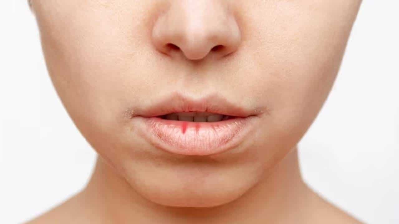 Dicas para cuidar dos lábios secos e evitar rachaduras