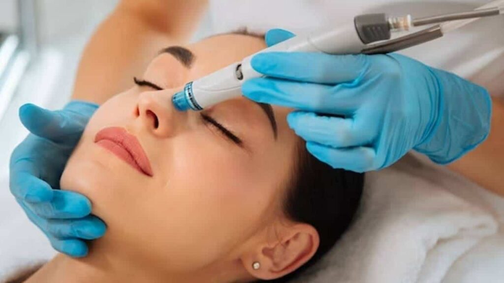 Hydrafacial: como funciona esse tratamento cada vez mais popular?