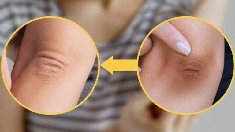 Método eficaz para clarear a pele dos cotovelos