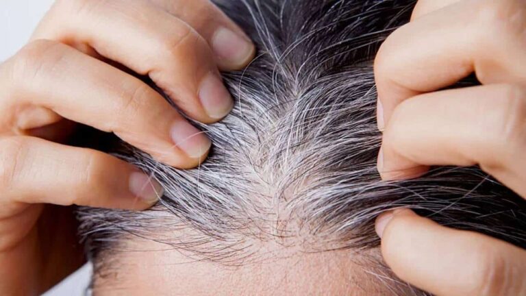 Quais são os cabelos grisalhos mais difíceis de cobrir e como usar mel para tingi-los?