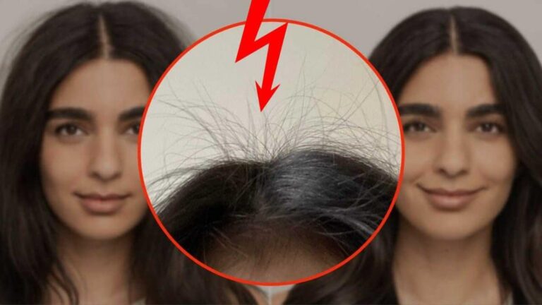 Você sempre tem cabelo eletrizado? Siga estas dicas para resolver
