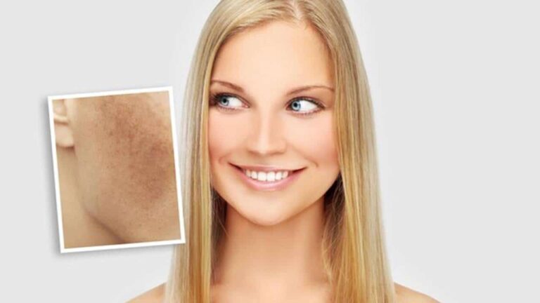 Máscara para manchas com efeito clareador feita com apenas 4 ingredientes