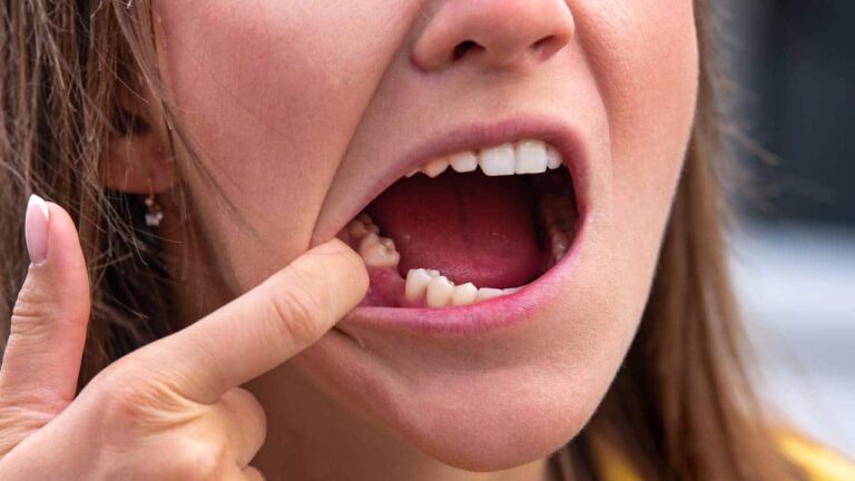 fazer crescer novamente os dentes caídos