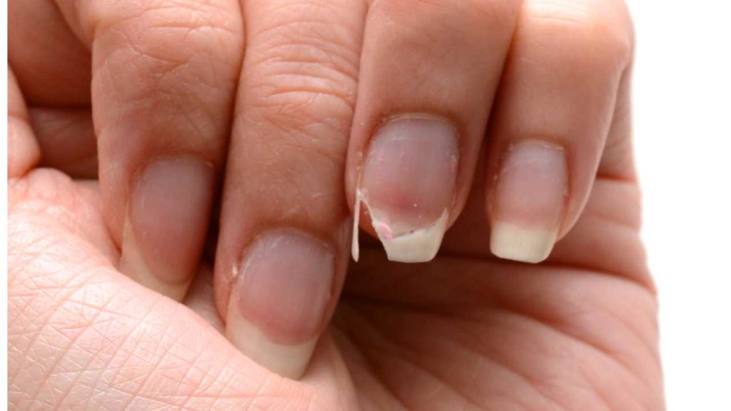 Segredo para que suas unhas não quebrem mais