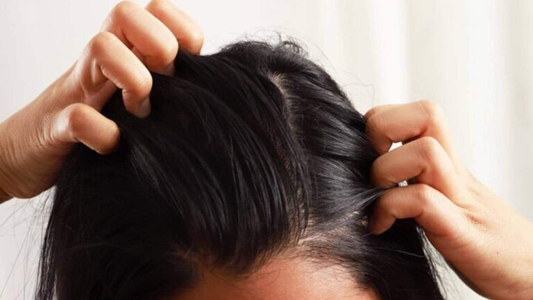 preencher falhas do cabelo e parar a queda!