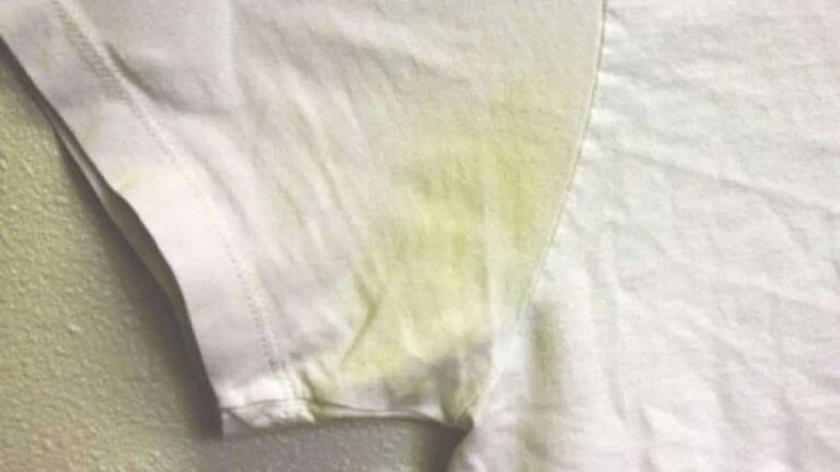 manchas amarelas nas roupas