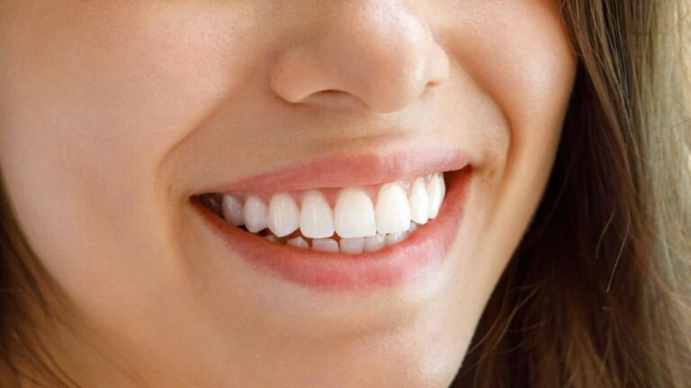 Dica para ter dentes brancos