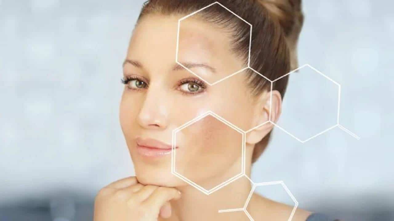 Conheça o ingrediente pouco conhecido que tira melasma e manchas do rosto