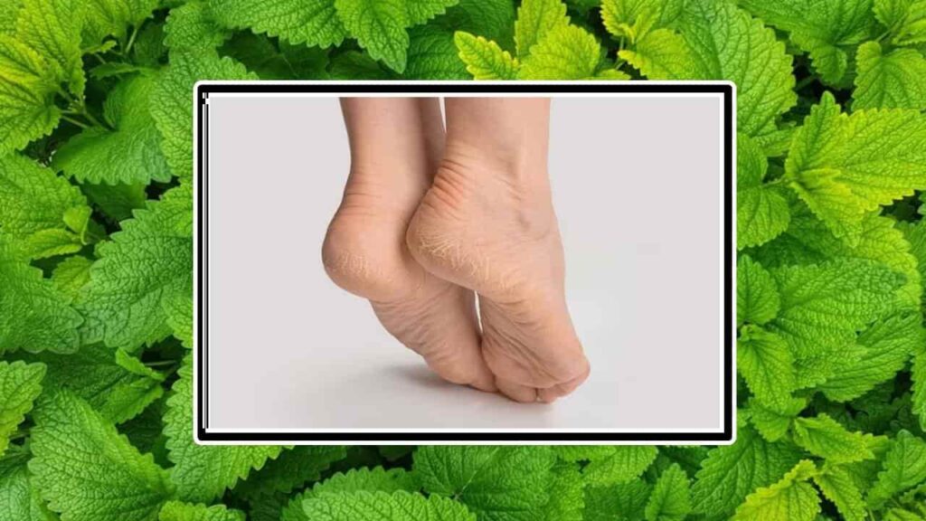 Aplique um poderoso esfoliante caseiro de hortelã para tratar pés rachados