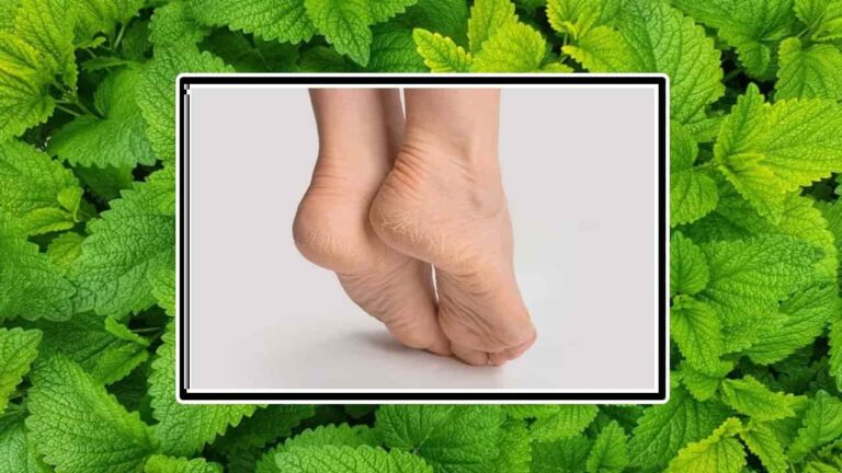 Aplique um poderoso esfoliante caseiro de hortelã para tratar pés rachados