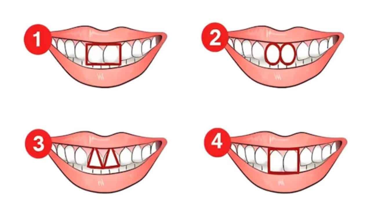 Este TESTE revela sua principal característica de acordo com seus dentes