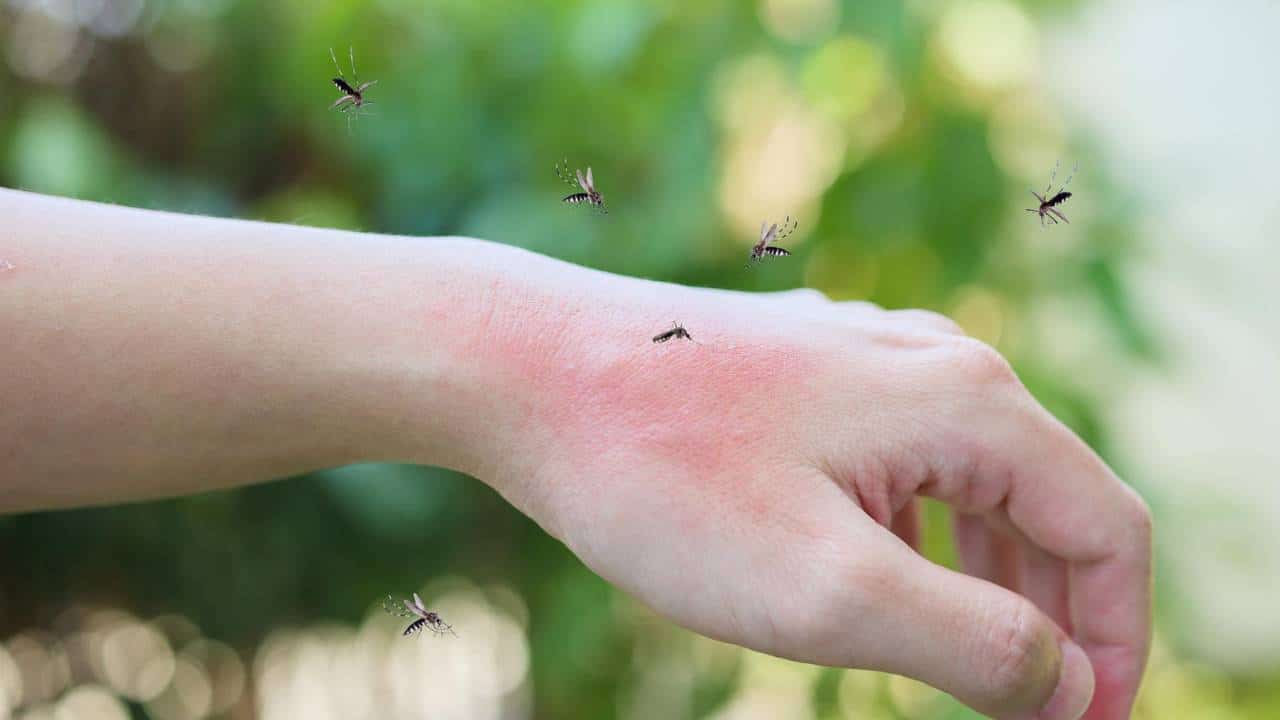 Como aliviar picadas de mosquito? Faça remédios caseiros!