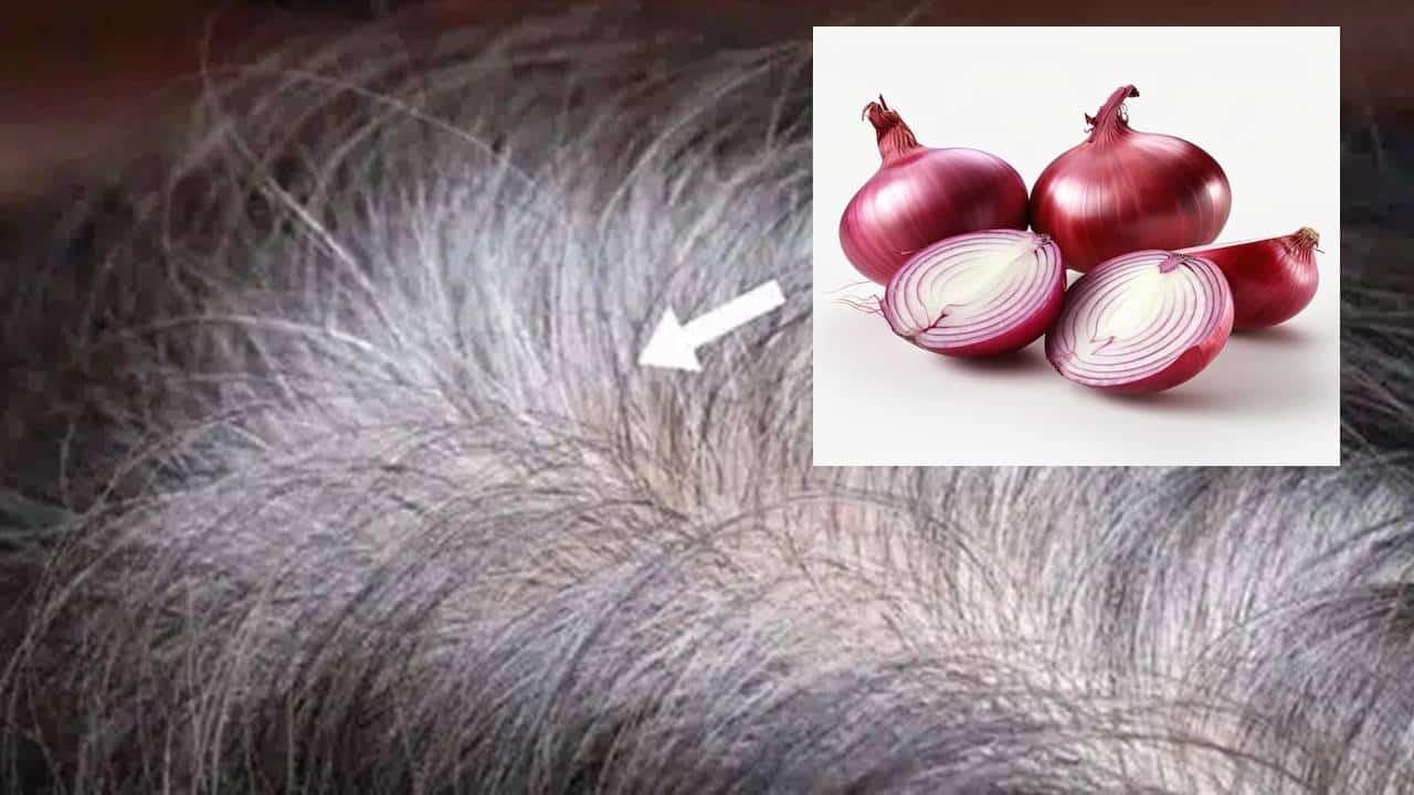 cabelos grisalhos usando cebola roxa