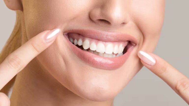 clarear os dentes naturalmente